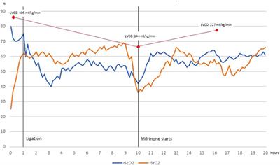 Findings From Somatic and Cerebral Near-Infrared Spectroscopy and Echocardiographic Monitoring During Ductus Arteriosus Ligation: Description of Two Cases and Review of Literature